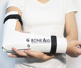 BoneAid Cast: Better Solution for Broken Body Parts?