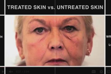 Second Skin Protects Dry Skin & Delivers Drugs